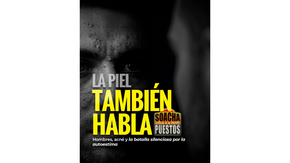 Pieza gráfica de La piel también habla con el primer plano del rostro de un hombre y el titular Hombres, acné y la batalla silenciosa por la autoestima